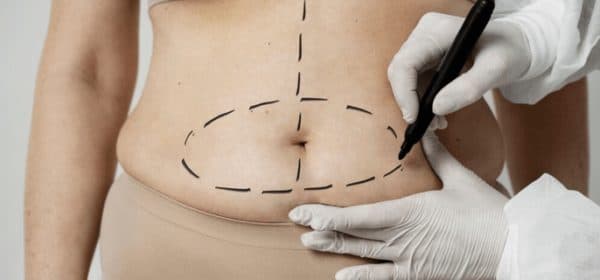 Procedure & Aftercare