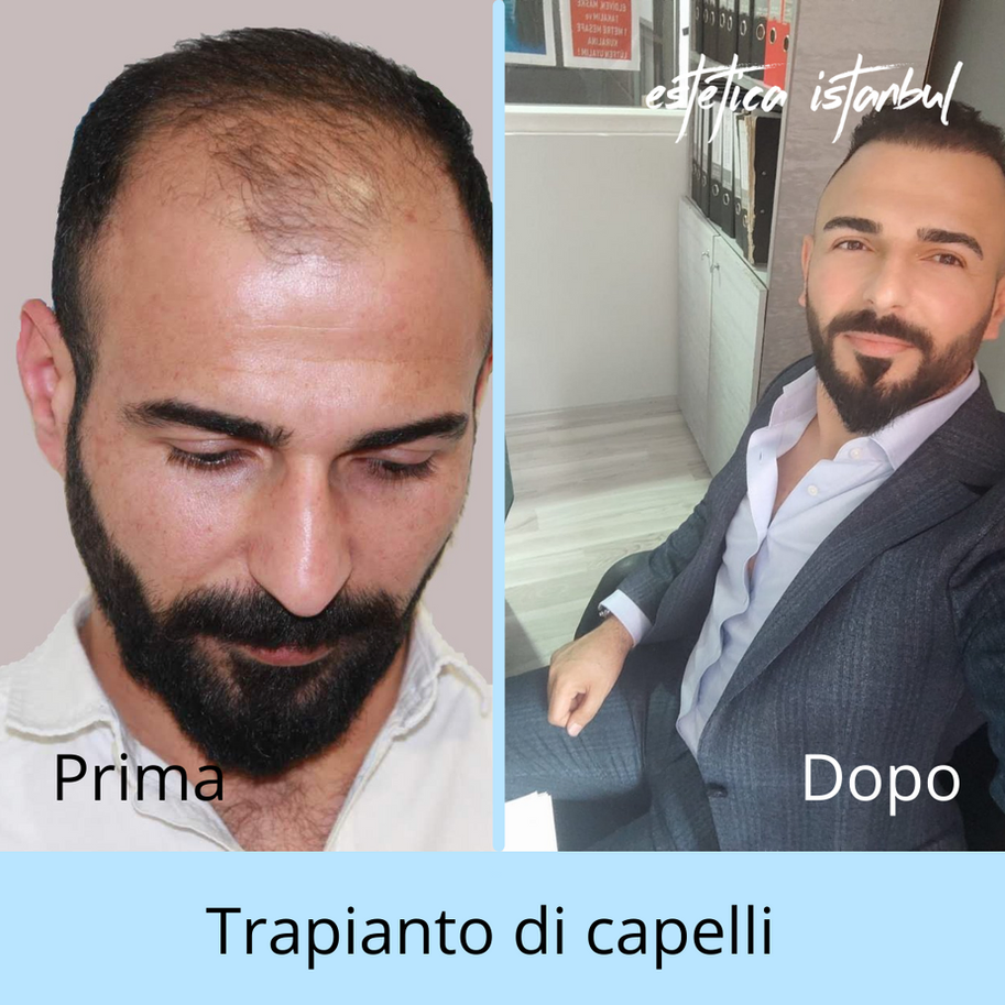 Slide 01
