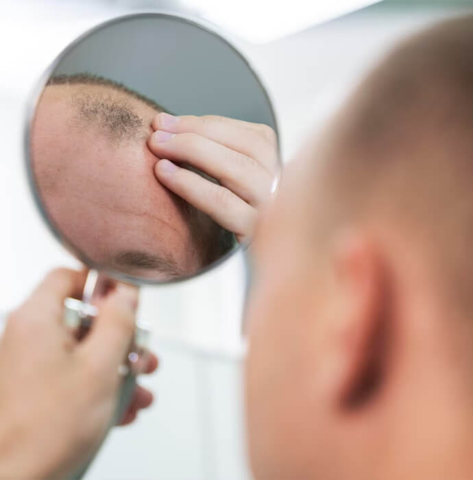 how-does-hair-transplant-work