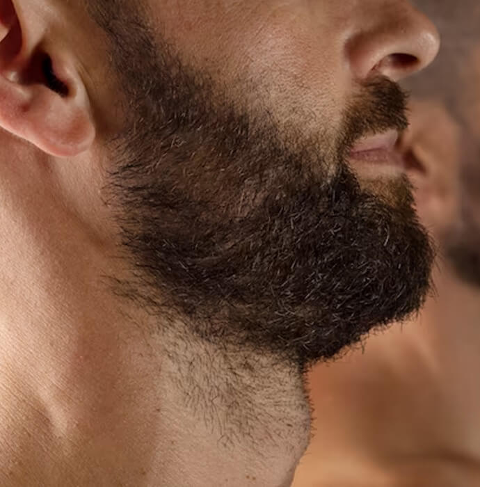 how-many-grafts-do-i-need-for-a-beard-transplant