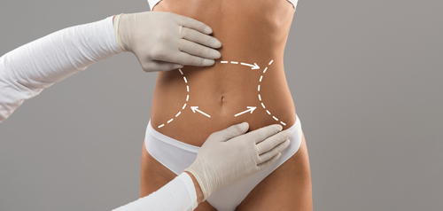 laser assisted liposuction surgery turkey
