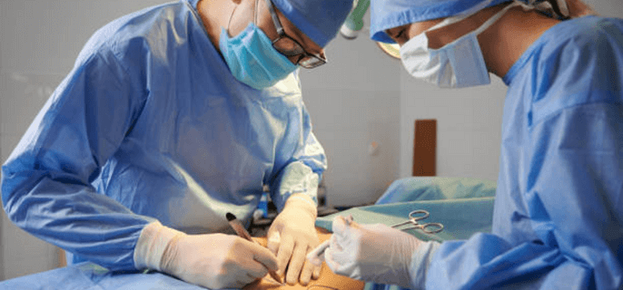abdominoplasty-procedure
