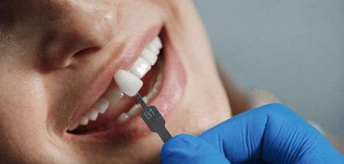 is it safe to go to turkey for dental veneers