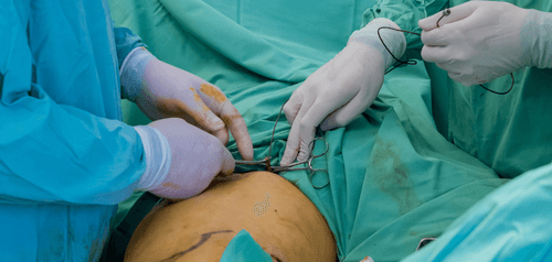 Why Turkey is a Popular Destination for Gastric Bypass Operation?